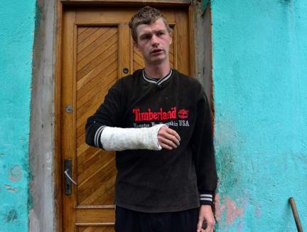 Bătut de "organe": Scuteristul agresat de poliţişti a făcut plângere la Parchetul Militar 